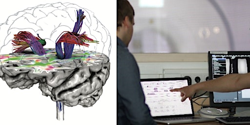 Primaire afbeelding van Prototype your own MRI Sequence [Workshop]