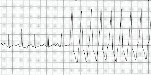 Imagem principal do evento ACLS  Blended Provider Course - Cowichan District Hospital - June 3, 2024