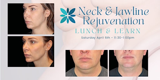 Neck & Jawline Rejuvenation Lunch & Learn primary image