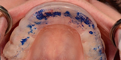 Imagem principal de The New Patient Exam & Diagnosis & Treatment of the TMJ Patient