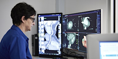 Hauptbild für General and Cardiac Imaging - Which Scan is Best?