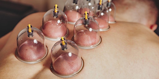 Primaire afbeelding van EASTERN AND WESTERN CUPPING TECHNIQUES