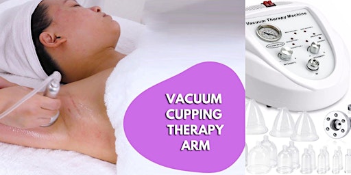 Primaire afbeelding van Therapeutic Cupping: Utilizing Vacuum Cupping Device Therapy for Wellness