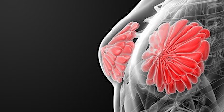 Breast Cancer Cause - Marketing. Welcoming an Era of More Diverse Campaigns  primary image