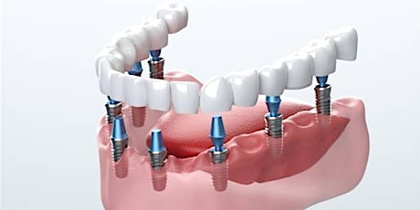 Hauptbild für 19th  Jesse T. Bullard Lectureship in Prosthodontics & Implant Dentistry