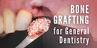 Imagem principal do evento Bone Grafting for General Dentistry and General Dentistry