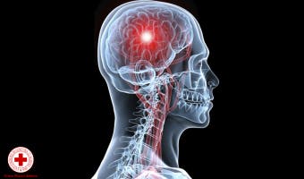 Corso “Sistema Nervoso e Apparato Locomotore: come è fatto, disturbi, traumi cranici e vertebrali, lesioni muscolo scheletriche e traumi osteoarticolari”