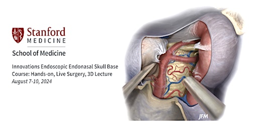 Imagem principal do evento 2024 Stanford Innovations in Endoscopic Endonasal Skull Base Surgery Course