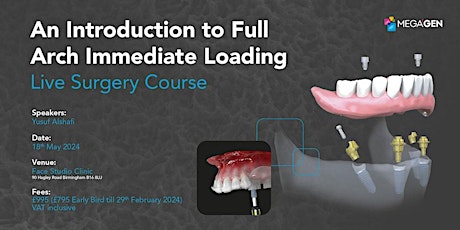 An Introduction to Full Arch Immediate Loading