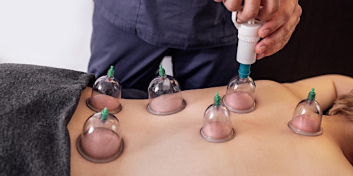 Hauptbild für Massage Cupping: Functional Myofascial Decompression