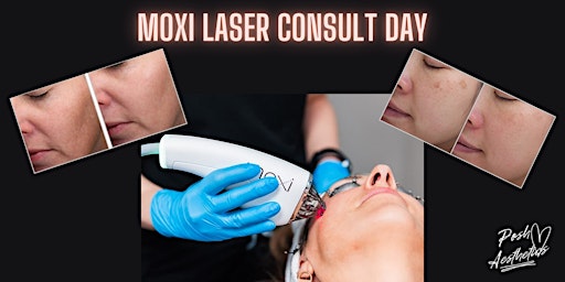 Moxi Laser Skin Treatment Consult Day primary image