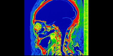 The Importance of the Human Brain in Ancient Egypt - By Sofia Aziz