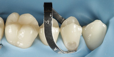 Hands on Rubber Dam for Dentists & Dental Therapists primary image
