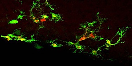 Neural Stem Cells: from model organisms to brain disorders