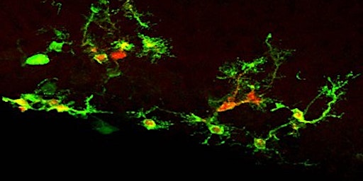 Primaire afbeelding van Neural Stem Cells: from model organisms to brain disorders