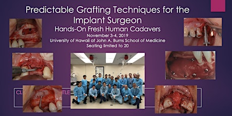 Predictable Grafting Techniques for the Implant Surgeon: Hands-on Fresh Human Cadavers primary image