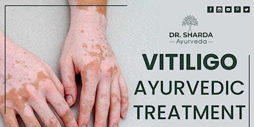Imagem principal do evento Providing Vitiligo Ayurvedic Treatment only at Dr. Sharda Ayurveda