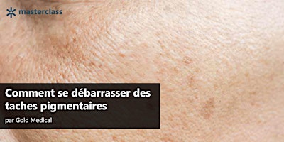 Comment se débarrasser des taches pigmentaires primary image