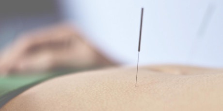 Croydon Community Acupuncture