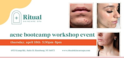 Imagem principal do evento FREE Acne Bootcamp Workshop Event at Ritual Skincare Spa!