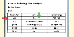 Imagem principal de PGH student nurse overview of blood gas analysis