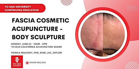 Fascia Cosmetic Acupuncture - Body Sculpture