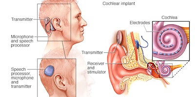 Treatment Options for Hearing Loss: The ENT's Perspective primary image