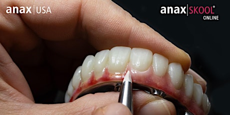 anaxskool Online: Esthetic Finishing of PMMA iBar Hybrids w/ Composite