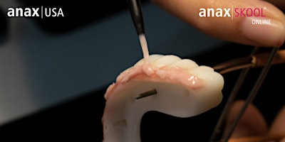 Immagine principale di anaxskool Online: Faster Finishing of Zirconia Hybrids w/ Paste Ceramic 