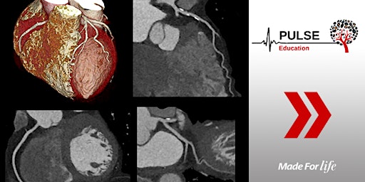 Primaire afbeelding van Canon Medical Cardiac CT Course for Radiographers - Sydney (NSW)