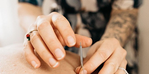 Is Acupuncture Right for Me? primary image