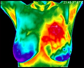 Breast Health and Thermography primary image