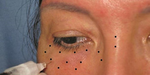 Image principale de Master Eye Injection Training -  Brooklyn, NY