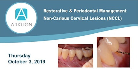 Restorative & Periodontal Management Non-Carious Cervical Lesions (NCCL)