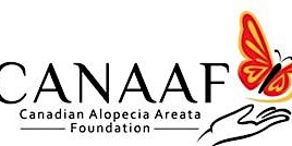Camp Summit - Canada’s First Summer Camp for Children with Alopecia Areata  primärbild