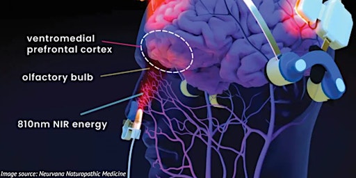 Imagen principal de Neurofeedback and Photobiomodulation Treatments for Peripheral Neuropathy