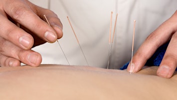 Immagine principale di Acupuncture Foundation Course (5-days) 