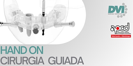 Hand on cirurgia guiada titaniumfix