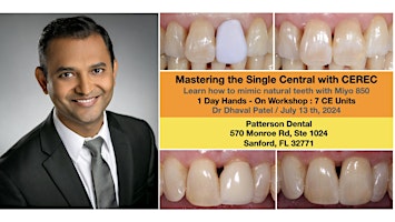 Imagem principal de Mastering the Single Central with Cerec