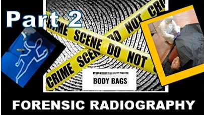 Forensic Radiology – Imaging with Body Bags