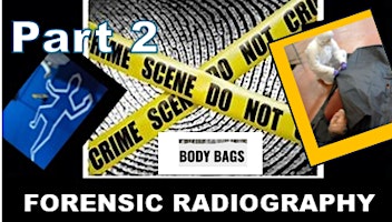 Imagen principal de Forensic Radiology – Imaging with Body Bags