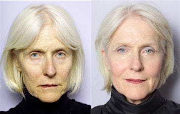 Sculptra Aesthetic Injection Training - Fort Lauderdale, FL primary image