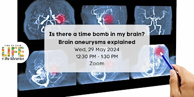 Imagem principal do evento Is there a time bomb in my brain? Brain aneurysms explained.