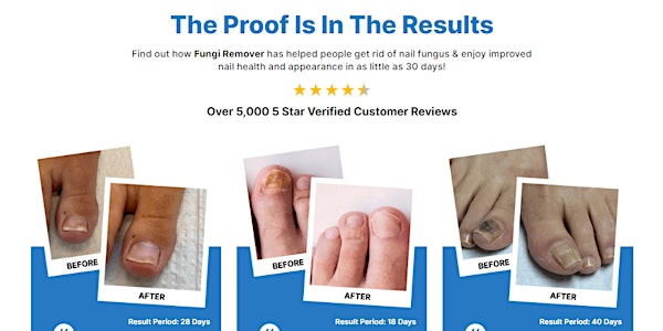 Nature's Remedy Fungi Remover Reviews (Australia, NZ, South Africa) Best Fungi Remover Program! Tickets, Thu, Dec 19, 2024 at 2:00 AM | Eventbrite Nature's Remedy Fungi Remover Reviews (Australia, NZ, South Africa) Best Fungi Remover Program! Tickets, Thu, Dec 19, 2024 at 2:00 AM | Eventbrite