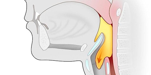 Stanford Healthcare's Swallowing Disorders Awareness  Symposium (In-Person) primary image