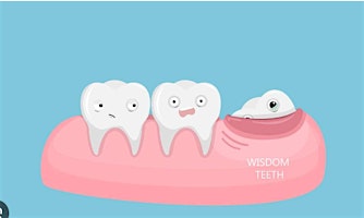 Hauptbild für Wisdom Teeth Management: A Comprehensive Guide for Dental Hygienist