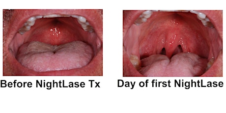 Soft & Hard Tissue Dental Lasers with Aesthetic Capabilities; 7 CE Credits primary image