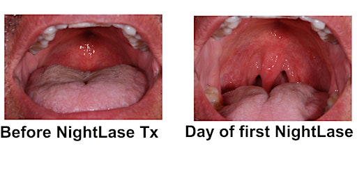 Hauptbild für Soft & Hard Tissue Dental Lasers with Aesthetic Capabilities; 7 CE Credits