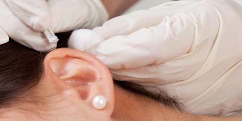 Hauptbild für Self Care - Auricular Acupuncture