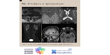 MRI Artefacts and Optimisation